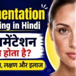 pigmentation meaaning in hindi, pigmentation meaning, pigmentation ka hindi kya hota hai, pigmentation kya hota hai, pigmentation in hindi, pigmentation ka matlab